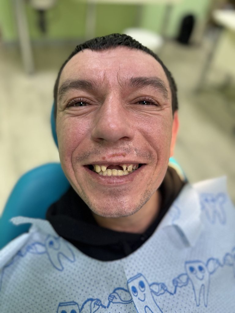 До. Посмішка захисника перед лікуванням