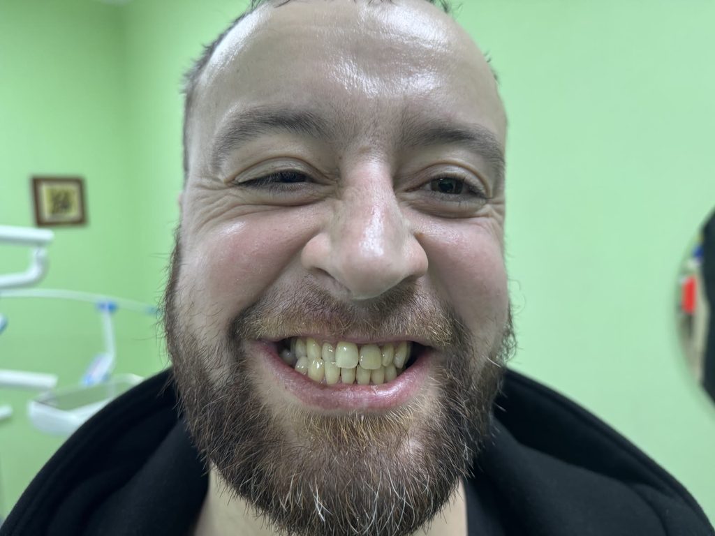 До. Посмішка захисника в клініці